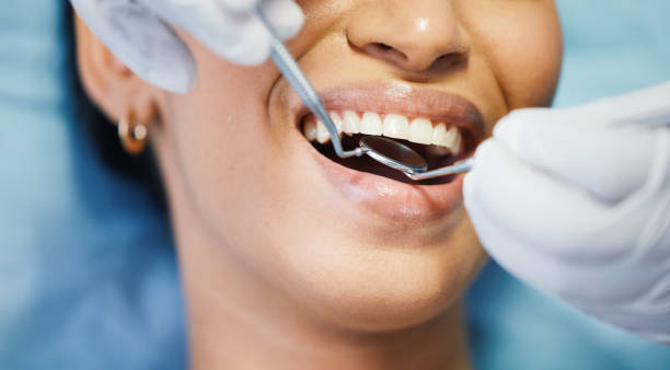 Best Emergency Tooth Extraction in Porterville, CA